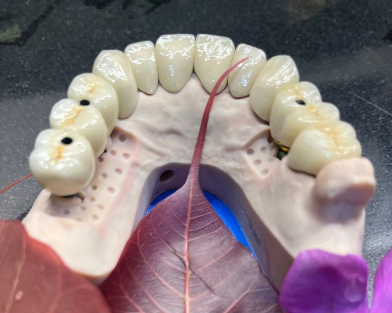 Full Mouth Rehabilitation: When Multiple Dental Problems Need One Complete Solution