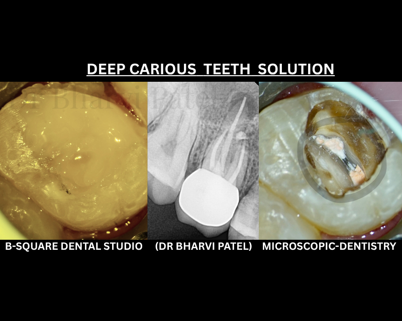 Root canal doesn't have to mean the horror story you've heard from everyone else. Under a microscope, it's a different experience entirely.