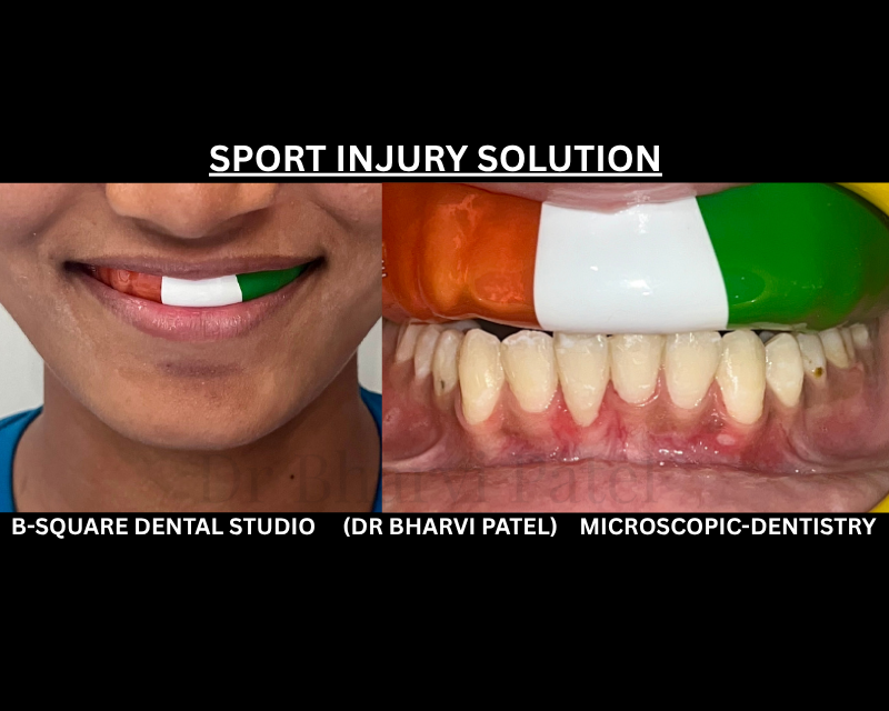 One custom-fit Sport guard, and years of playing without a single dental injury instead of one bad hit undoing years of dental work.