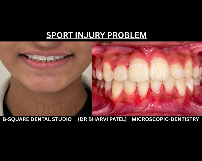 You wear a helmet, knee pads, shin guards to avoid from injury while playing sport and leave the one thing that can't fully grow back unprotected."