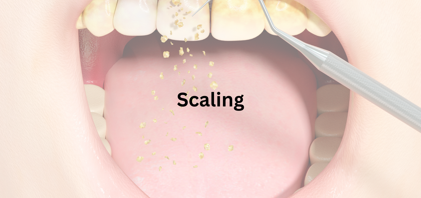 SCALING